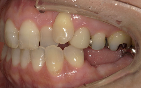 Before image