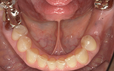 Before image
