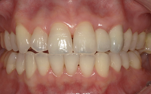 After image