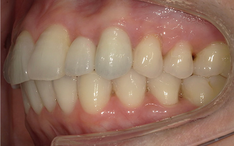 After image