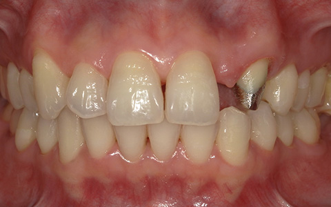 Before image