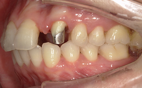 Before image