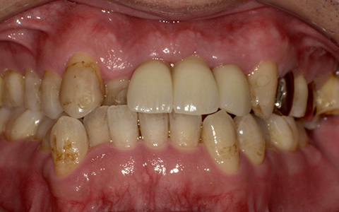 After image
