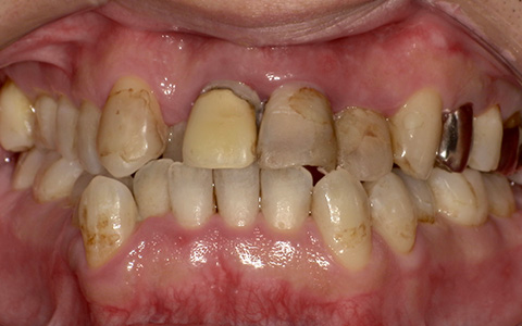 Before image