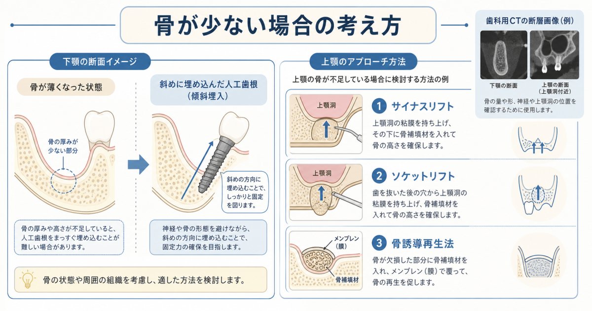 人工歯根を用いた全顎治療の費用相場と内訳の目安