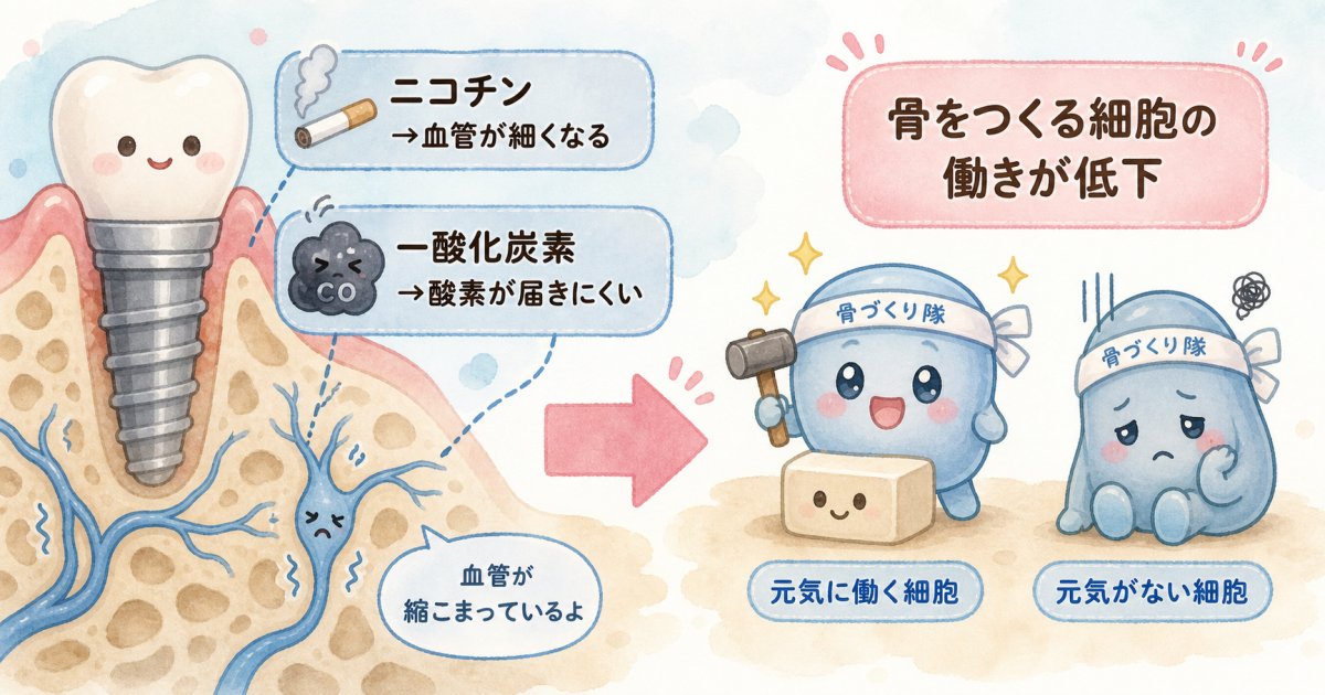 喫煙がインプラントの骨結合を阻む医学的理由と影響