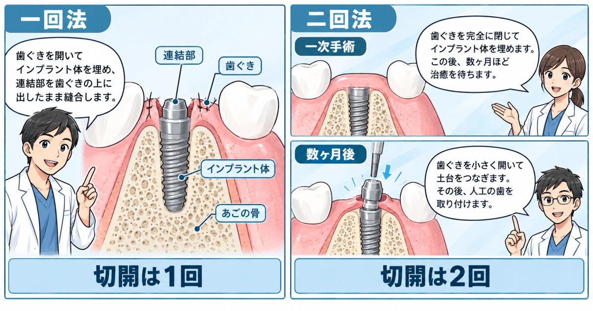 一回法と二回法の基本的な違い（手順・切開回数・治療期間）