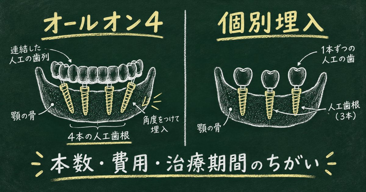 骨が薄い方向け｜オールオン4と個別埋入の違いを本数費用で解説