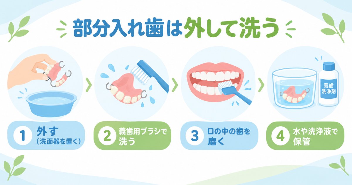 部分入れ歯の手入れは、外して洗う工程が中心