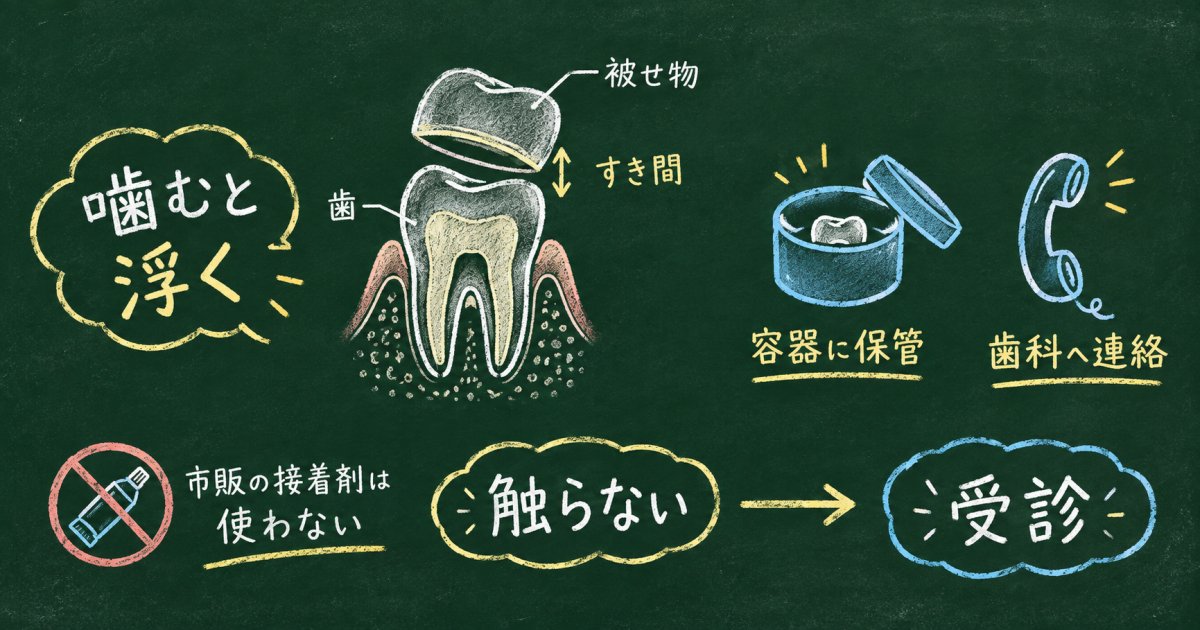 仕事前に被せ物がゆるいと感じたら？受診目安と外れた時の対処
