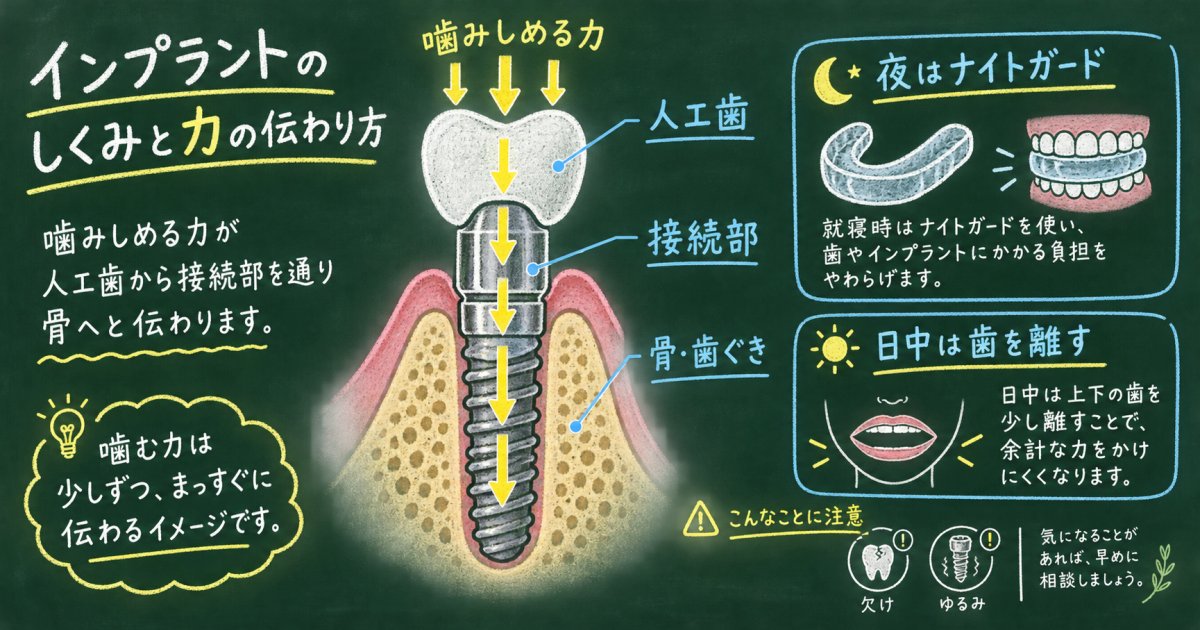 食いしばりが人工歯根へ与える影響と治療後に噛む力から守る対策