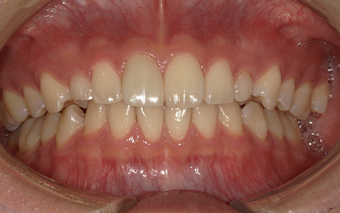 Before image