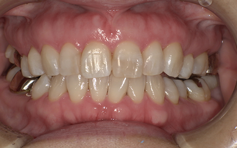 After image