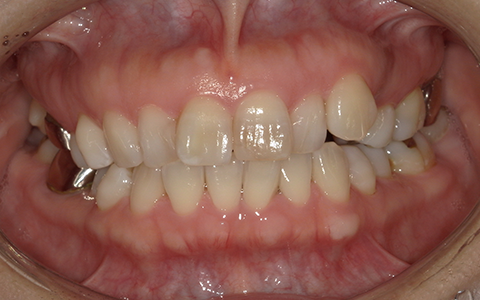 Before image