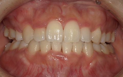 After image