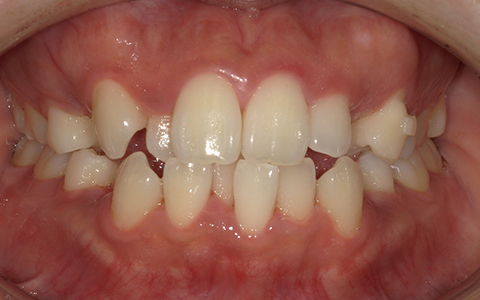 Before image