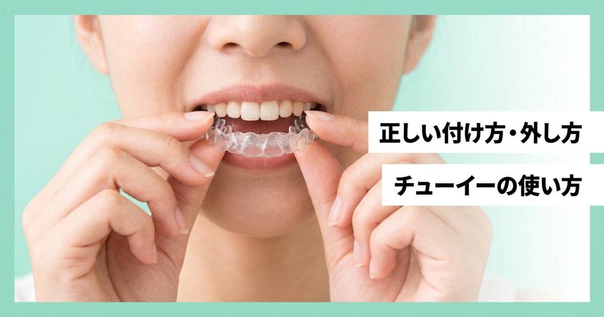マウスピースの付け方ガイド｜インビザラインの正しい着脱とコツ