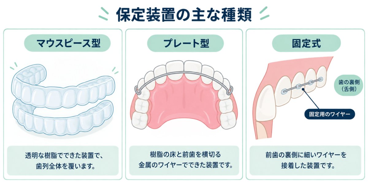 保定装置の種類と装着時間への影響