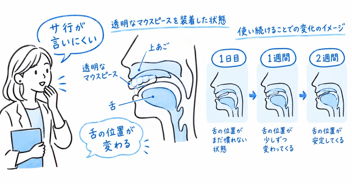 マウスピース矯正でサ行が言いにくくなる期間と授業への影響