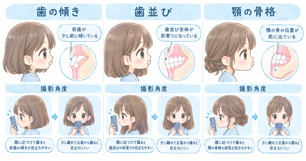 横顔の口元が突出して見える理由と、写真で分かる限界
