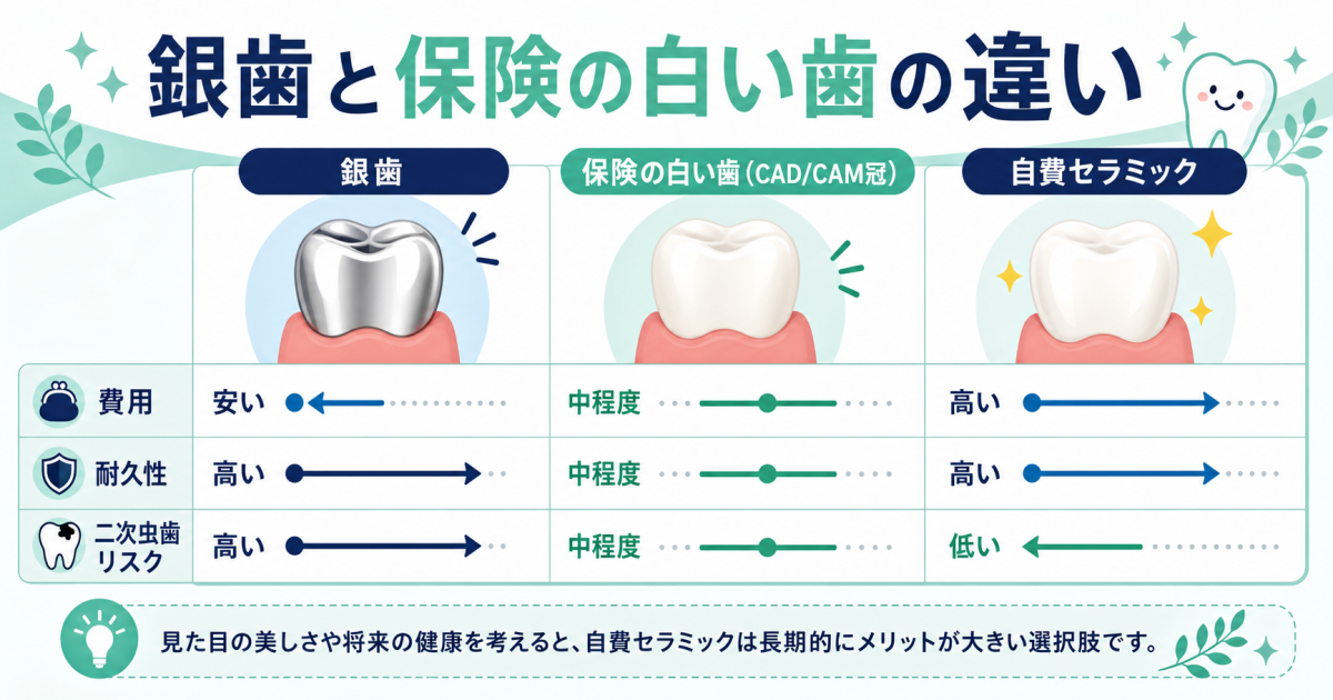 銀歯と保険の白い歯の違いは?費用や耐久性・二次虫歯リスクを比較