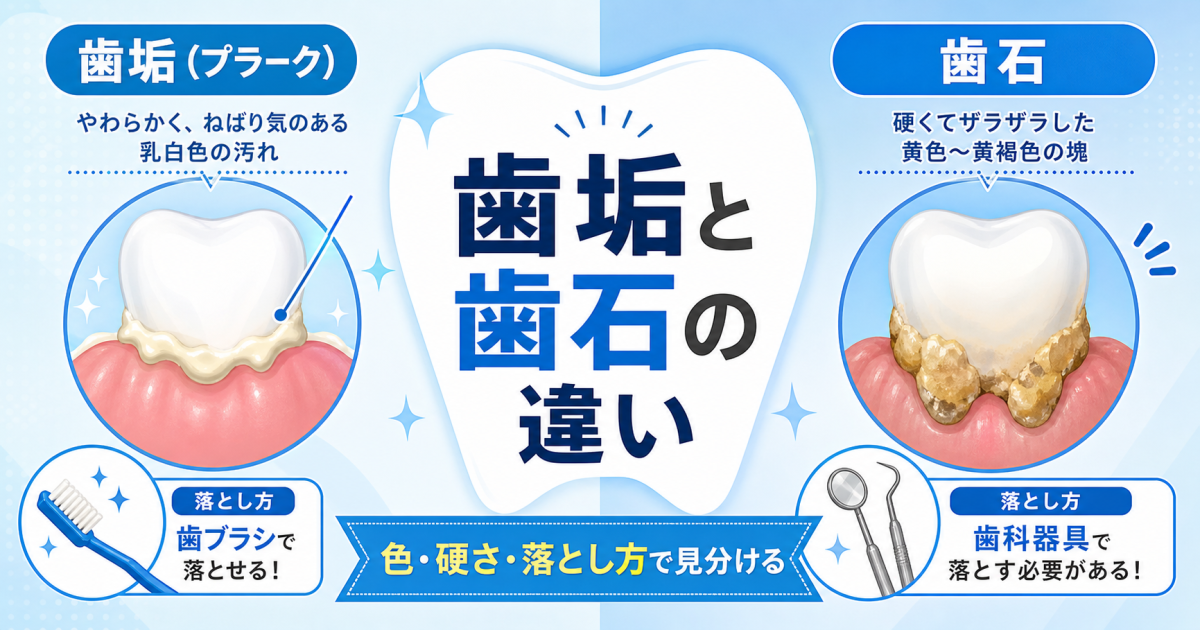 前歯の白い塊はどっち？歯垢と歯石の違い・見分け方とケア方法