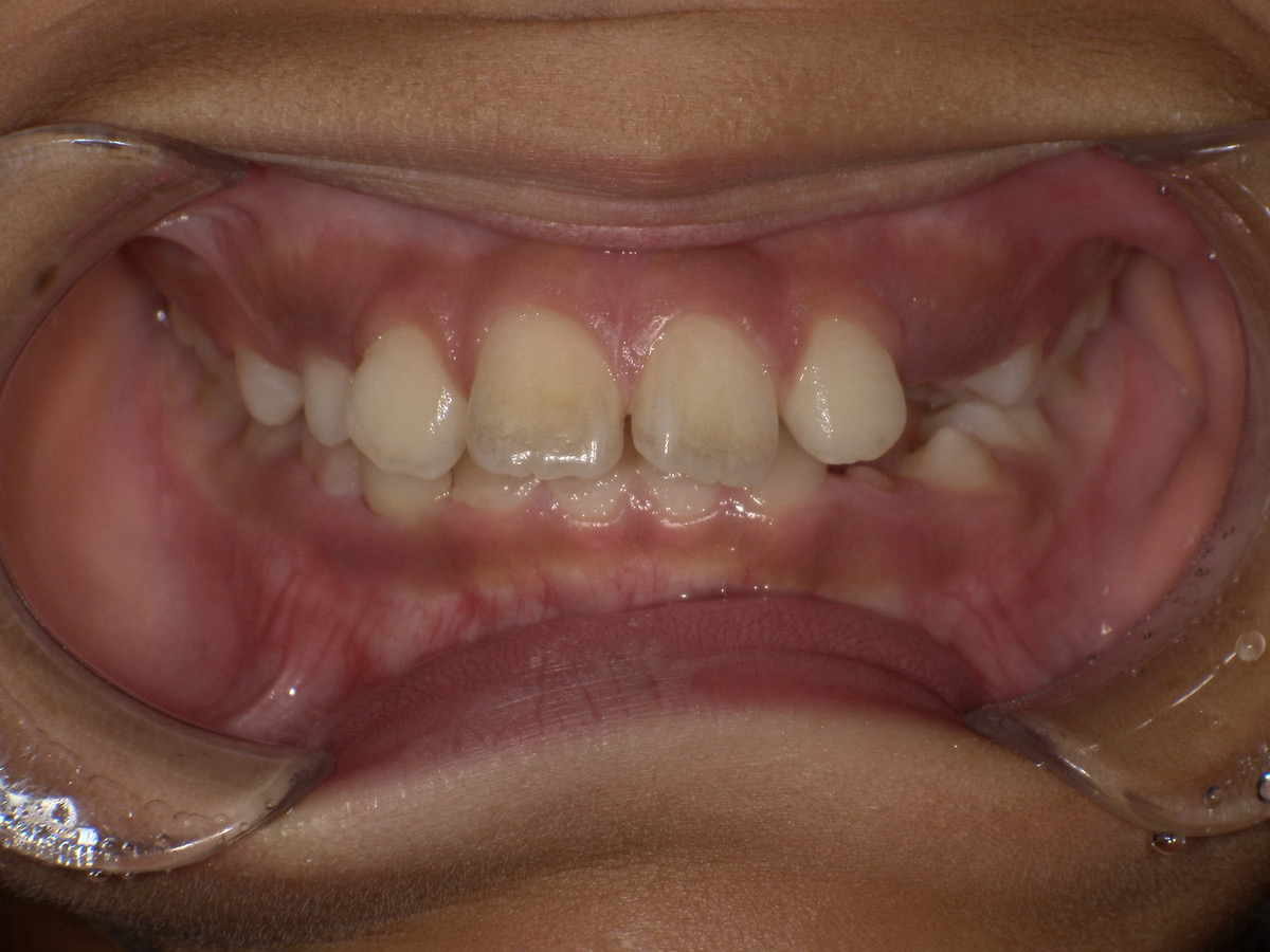 Before image