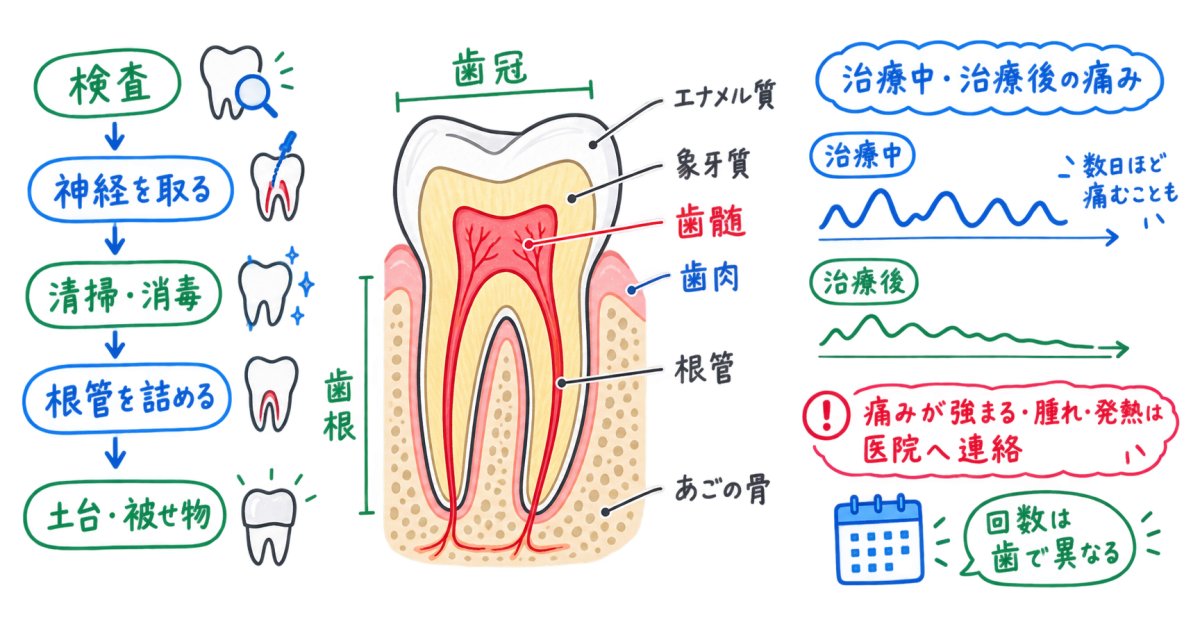 根管治療で神経を抜くのが怖い方へ｜治療中・治療後の痛みと通院回数