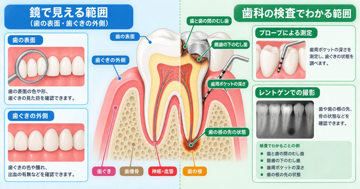 歯科の健康診断では何を調べる?見た目ではわからない部分の確認方法